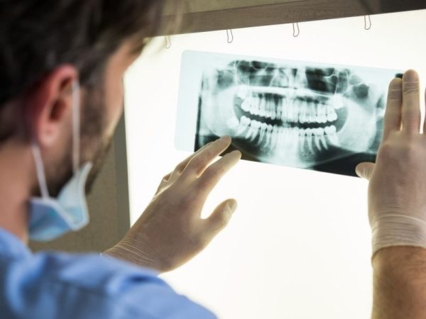 Kateri zobni rentgen izbrati
